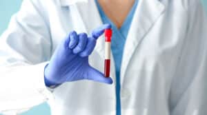 Scopri di più sull'articolo Esami del sangue in farmacia: sono attendibili?